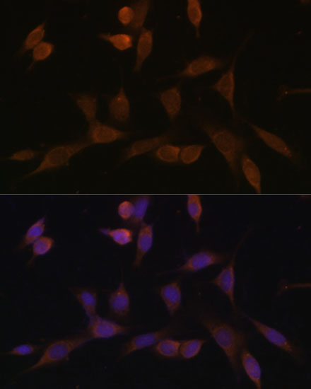 Anti-NDUFA5 Antibody [KO Validated] (CAB14751)