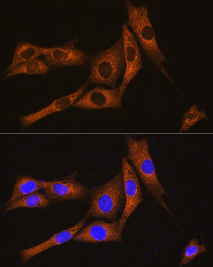 Anti-GNAT3 Antibody (CAB15982)