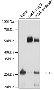 Anti-PID1 Antibody (CAB13220)