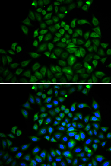 Anti-FABP4 Antibody (CAB0232)