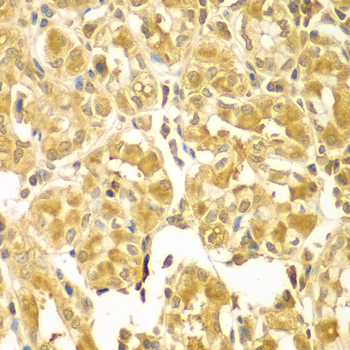 Anti-SESN2 Antibody (CAB7515)