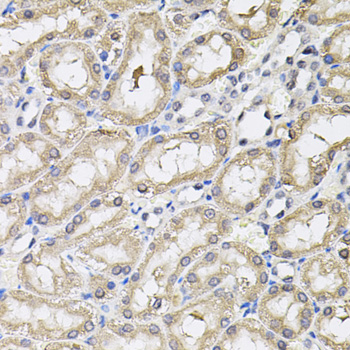 Anti-RNF166 Polyclonal Antibody (CAB8276)