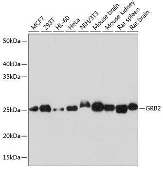 Anti-GRB2 Antibody (CAB19059)