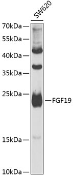 Anti-FGF19 Antibody (CAB6589)