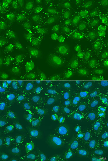 Anti-XBP1 Antibody (CAB14651)