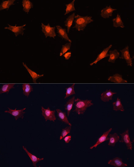 Anti-KLF5 Antibody (CAB2989)