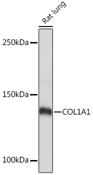 Anti-COL1A1 Antibody (CAB16891)