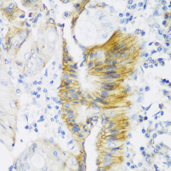 Anti-CLDN4 Antibody (CAB12912)