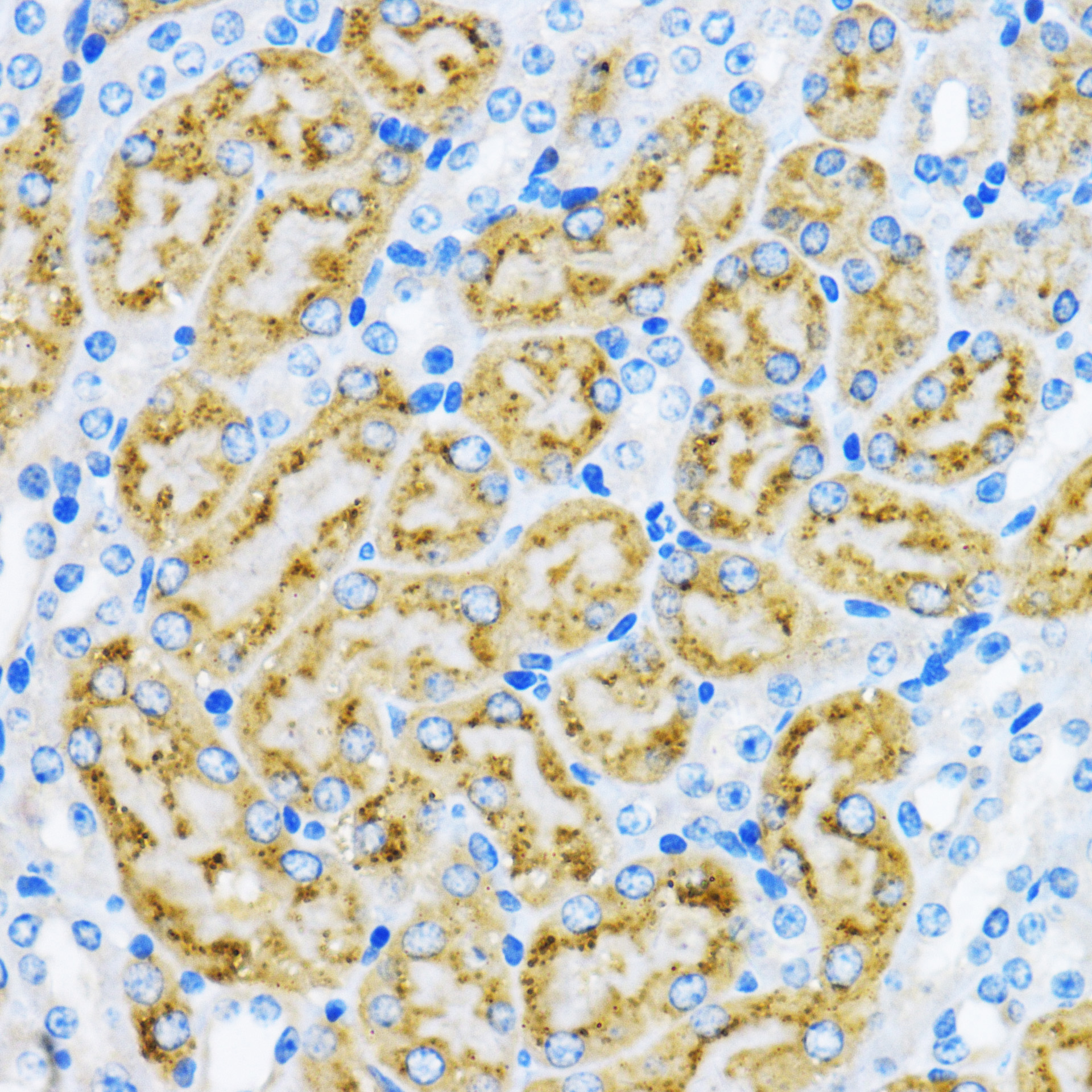 Anti-EEA1 Antibody (CAB0592)