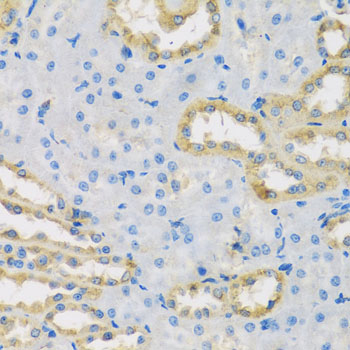 Anti-HS1BP3 Polyclonal Antibody (CAB8250)