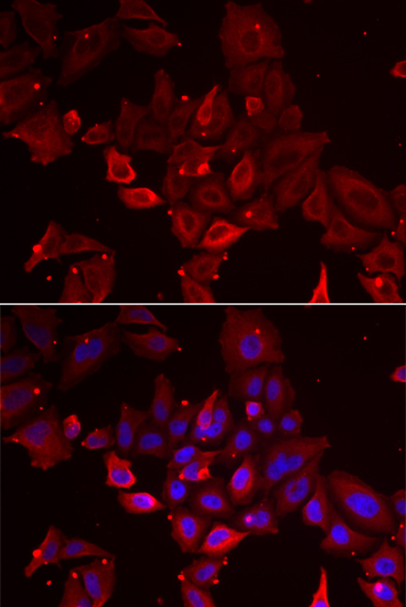 Anti-MYOT Antibody (CAB6439)