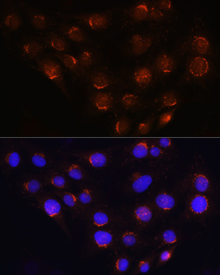 Anti-GOLGA4 Antibody (CAB10216)