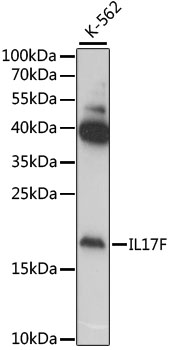 Anti-IL-17F Antibody (CAB6487)