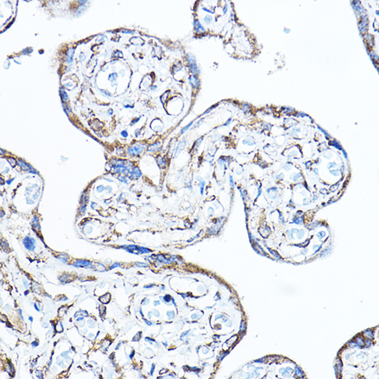 Anti-PDK4 Antibody (CAB13337)