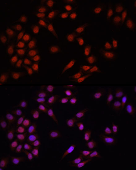 Anti-PRDM14 Antibody (CAB6502)