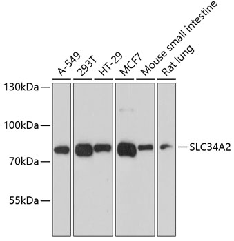 Anti-SLC34A2 Polyclonal Antibody (CAB9460)