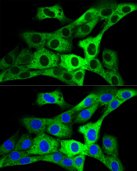 Anti-GARS Antibody (CAB5435)