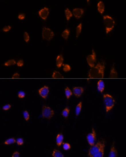 Anti-PDHA1 Antibody (CAB1895)