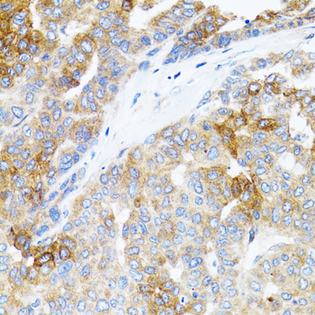 Anti-STAT3 Antibody (CAB5511)