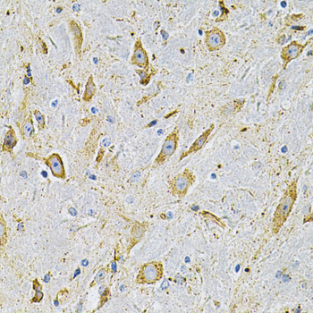 Anti-Fibronectin Antibody (CAB7488)