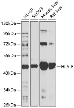 Anti-HLA-E Antibody (CAB14206)