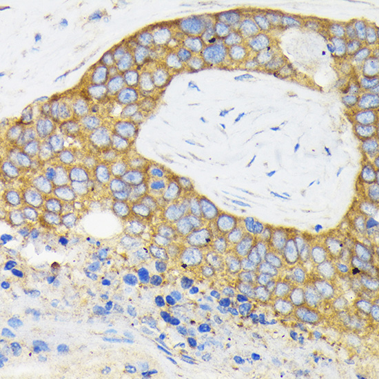 Anti-RPS3 Antibody (CAB2533)