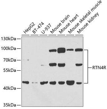 Anti-RTN4R Antibody (CAB5847)