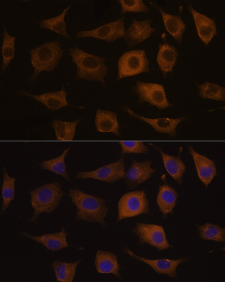 Anti-CHRNA7 Antibody (CAB1588)