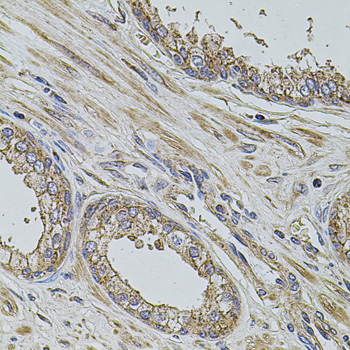 Anti-ALIX / PDCD6IP Antibody (CAB2215)