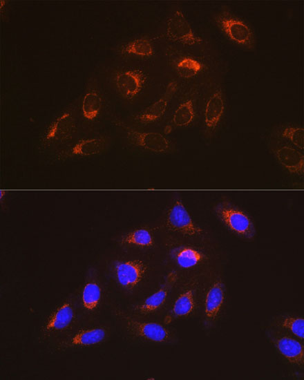 Anti-FAK Antibody (CAB11131)