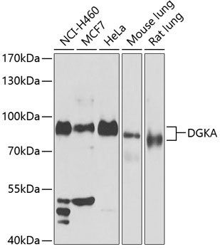 Anti-DGKA Antibody (CAB13969)