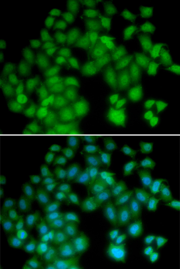 Anti-TMSB4X Antibody (CAB5438)