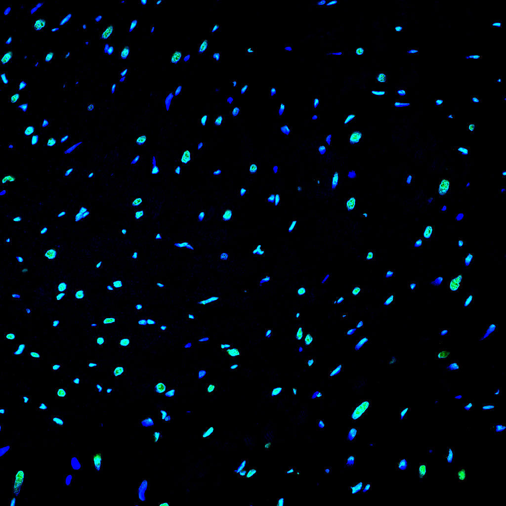 Paraffin embedded rat heart was treated with DNAse I to fragment the DNA. DNA strand breaks showed intense fluorescent staining in DNAse I treated sample (green). The cells were counterstained with DAPI (blue). This photo was taken by confocal microscope.