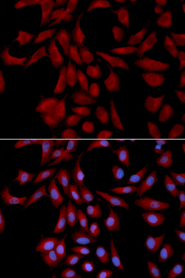 Anti-UBE2I Antibody (CAB13558)