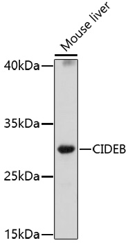 Anti-CIDEB Antibody (CAB17141)