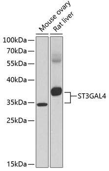 Anti-ST3GAL4 Antibody (CAB13544)