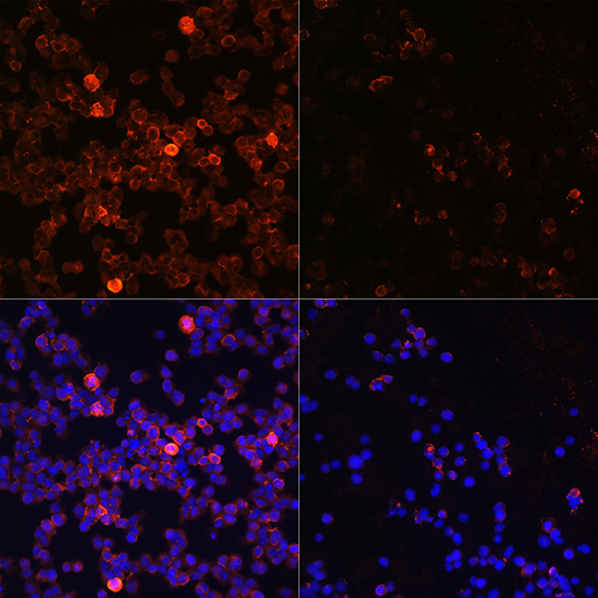 Anti-Phospho-ZAP70-Y493 Antibody (CABP0468)