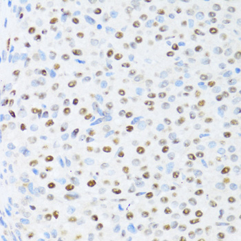 Anti-DDX39B Polyclonal Antibody (CAB8356)