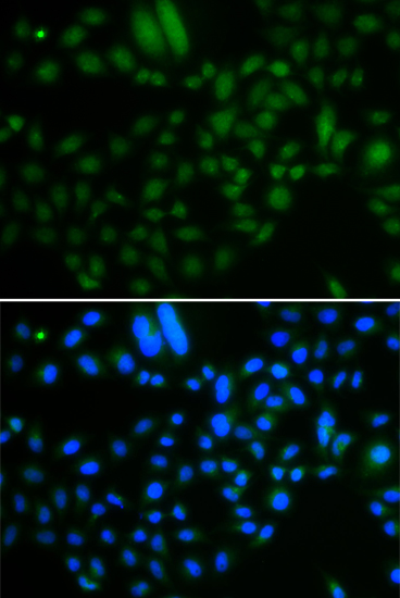 Anti-ALKBH8 Antibody (CAB7142)