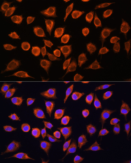 Anti-FXN / Frataxin Antibody (CAB11785)