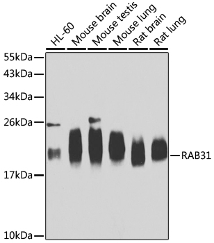 Anti-RAB31 Antibody (CAB7506)