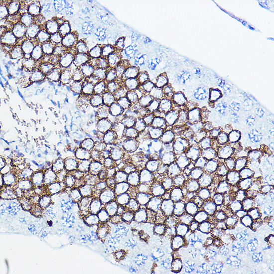 Anti-HER2 / ErbB2 Antibody [KO Validated] (CAB2071)