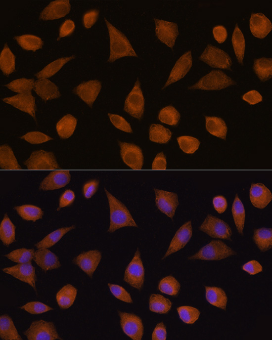 Anti-CRYZ Antibody (CAB12857)