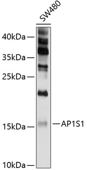 Anti-AP1S1 Antibody (CAB10558)