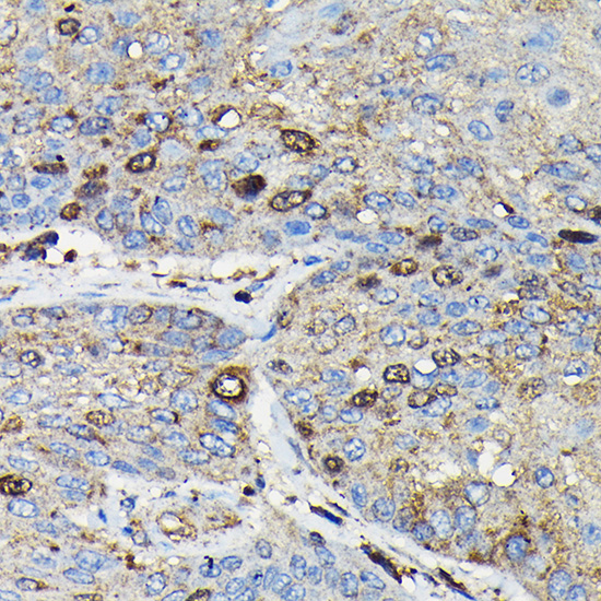 Anti-PRC1 Antibody (CAB7029)