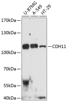 Anti-CDH11 Antibody (CAB12176)