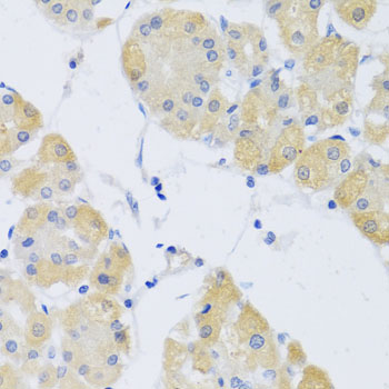 Anti-CLIP1 Antibody (CAB7722)