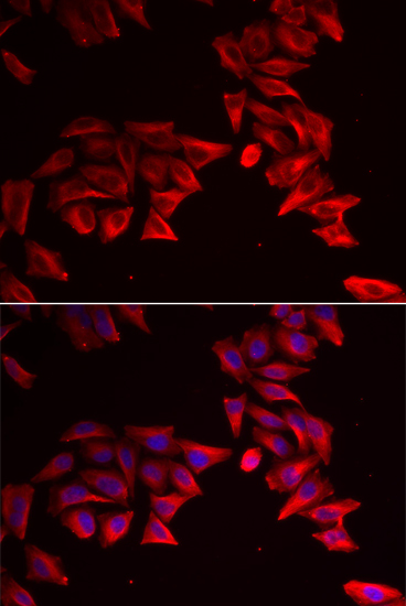 Anti-SFRP4 Antibody (CAB6409)