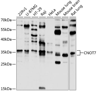 Anti-CNOT7 Polyclonal Antibody (CAB8959)