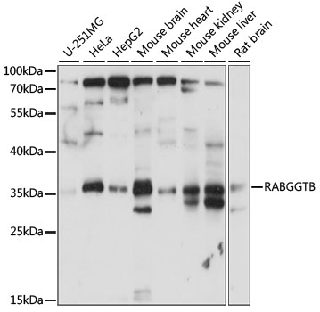 Anti-RABGGTB Antibody (CAB15310)